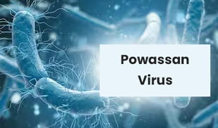 Powassan Virus: After Corona, This Virus Spread, 1 Death In America Due To Powassan Virus, Know Its Symptoms And Prevention From Experts