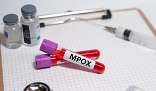 Debunking Common Myths About Mpox: What You Need to Know
