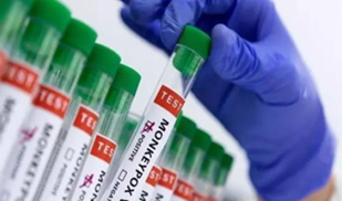 Karnataka reports first Mpox case this year as 40-year-old Dubai returnee tests positive