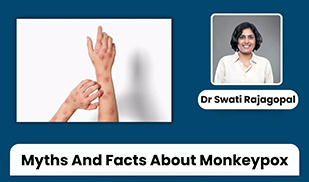 Debunking Common Myths About Monkeypox: Facts You Need to Know - Dr Swati Rajagopal